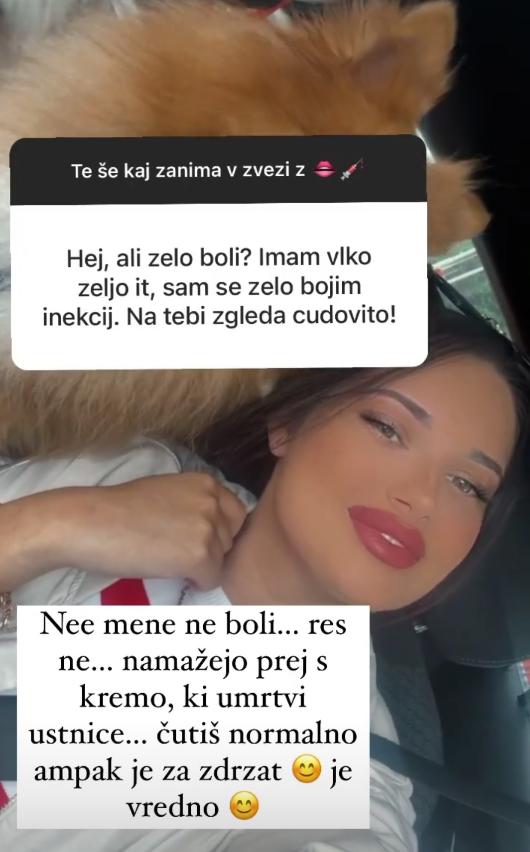 Ana odkrito o posegu: Takšna je bila prej.