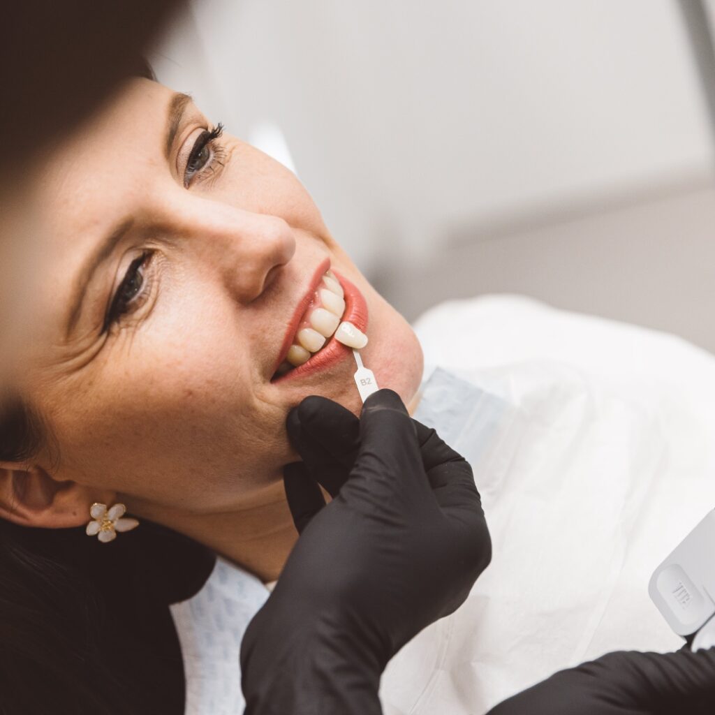 7 mitov in resnic o beljenju zob