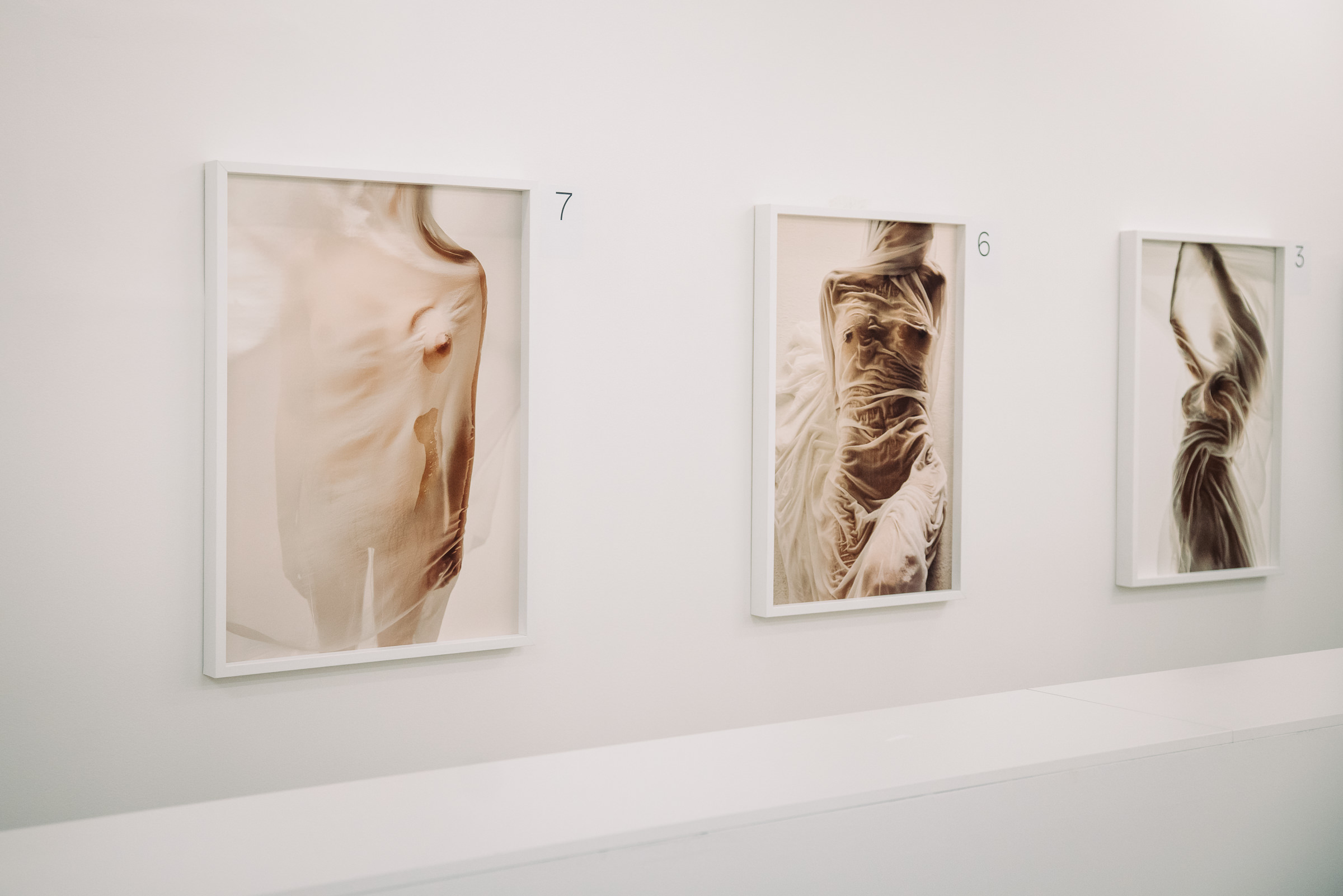 Ko umetnost postane dobrodelnost: zgodba, ki združuje pogum, lepoto in solidarnost