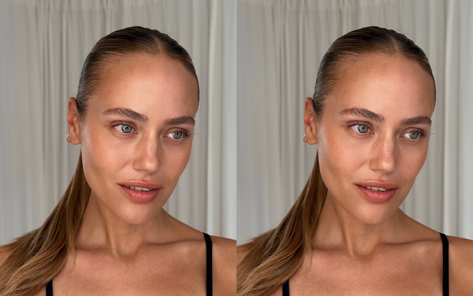 Kako zmanjšati gube na čelu brez pretiravanja z injekcijami